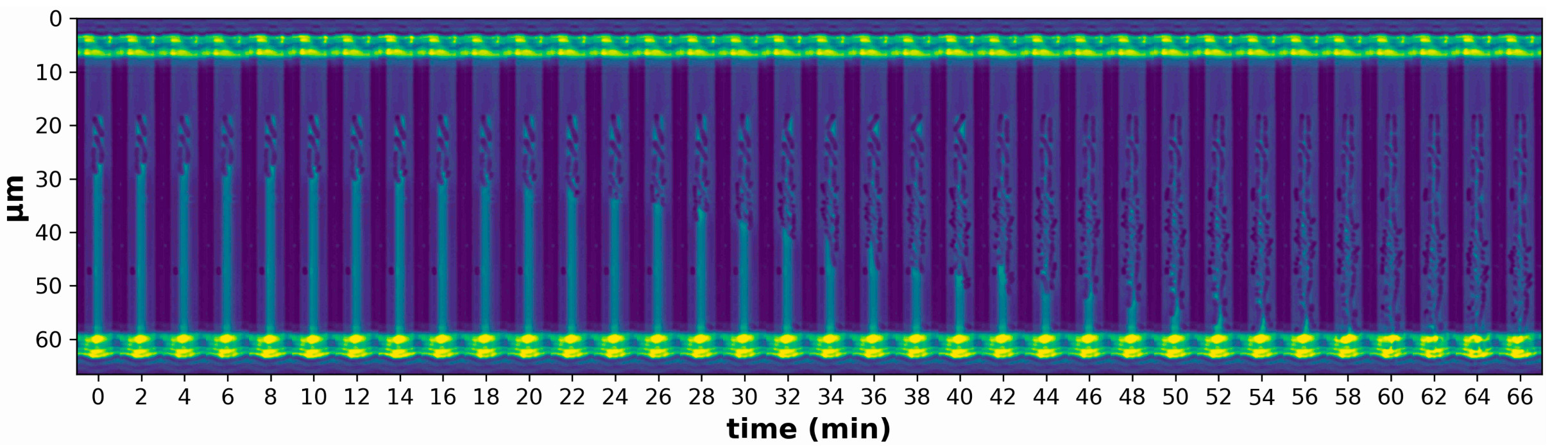 Temporal montage of micrographs of a single mother machine trench (kymograph) showing initial loading and subsequent replication of bacteria. Channel diameter: 5 μm.