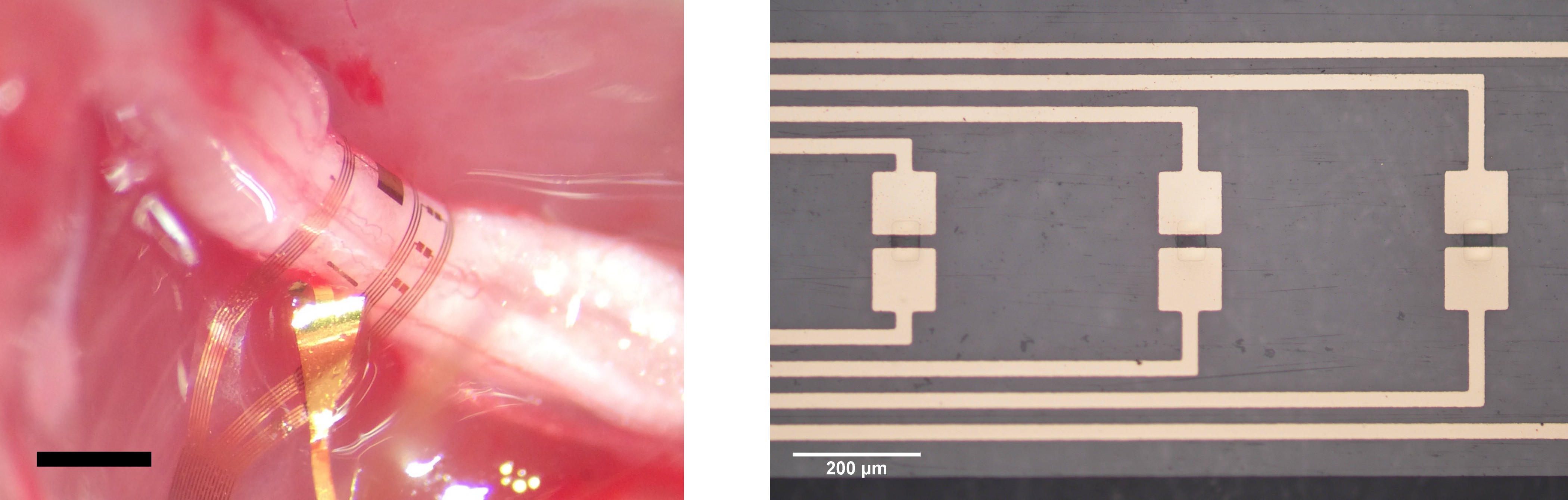 Left: Flexible polymeric implant with microelectrode and OECT arrays wrapped around the sciatic nerve. Scale bar: 1 cm. Right: OECTs on the flexible implant.